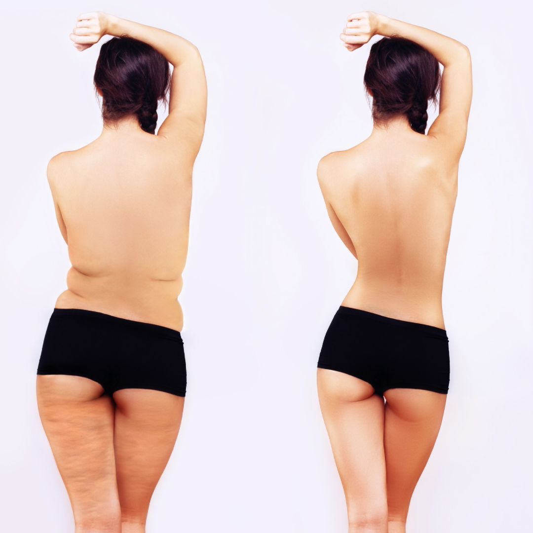 Female Fat Loss in Dubai - Best Personal Trainer and Nutrition Coach in Dubai Abhinav Malhotra AbhiiFit