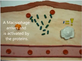 Inflammatory Process - 10 - Best Personal Trainer Abhinav Malhotra Dubai UAE