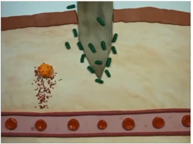 Inflammatory Process - 5 - Best Personal Trainer Abhinav Malhotra Dubai UAE